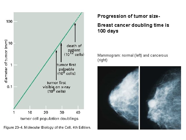 Progression of tumor size. Breast cancer doubling time is 100 days Mammogram: normal (left)