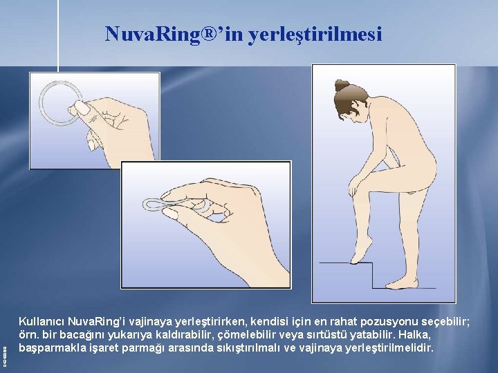 0434006/9 Nuva. Ring®’in yerleştirilmesi Kullanıcı Nuva. Ring’i vajinaya yerleştirirken, kendisi için en rahat pozusyonu 0434006/9 Nuva. Ring®’in yerleştirilmesi Kullanıcı Nuva. Ring’i vajinaya yerleştirirken, kendisi için en rahat pozusyonu
