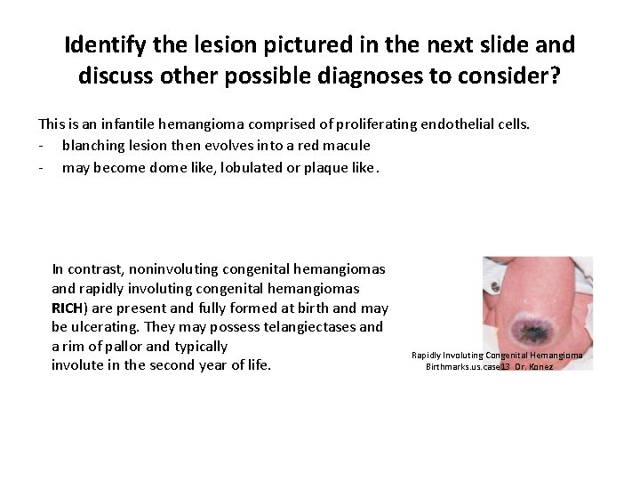 Identify the lesion pictured in the next slide and discuss other possible diagnoses to
