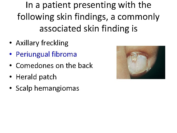 In a patient presenting with the following skin findings, a commonly associated skin finding