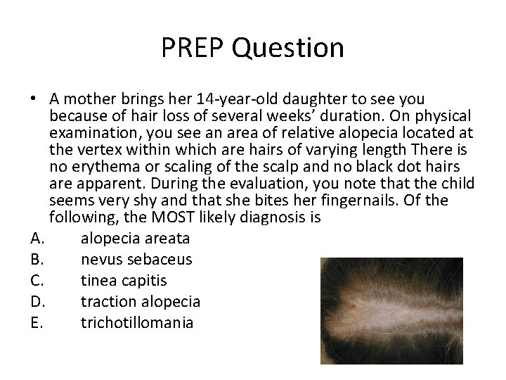 PREP Question • A mother brings her 14 -year-old daughter to see you because