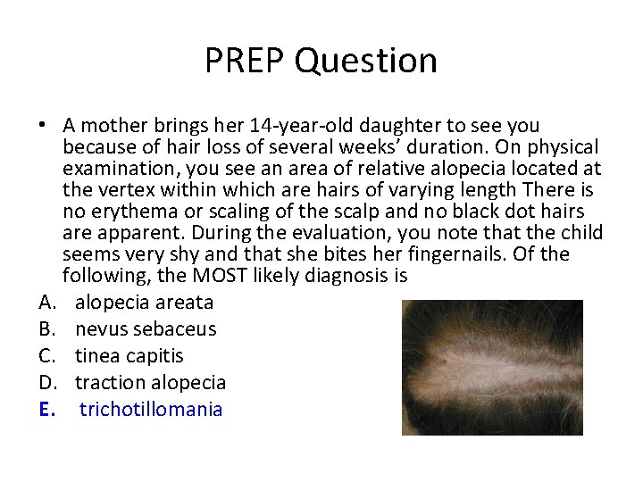 PREP Question • A mother brings her 14 -year-old daughter to see you because