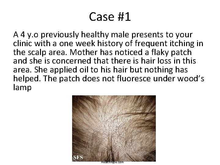Case #1 A 4 y. o previously healthy male presents to your clinic with