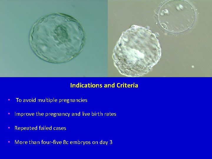 Indications and Criteria • To avoid multiple pregnancies • Improve the pregnancy and live Indications and Criteria • To avoid multiple pregnancies • Improve the pregnancy and live