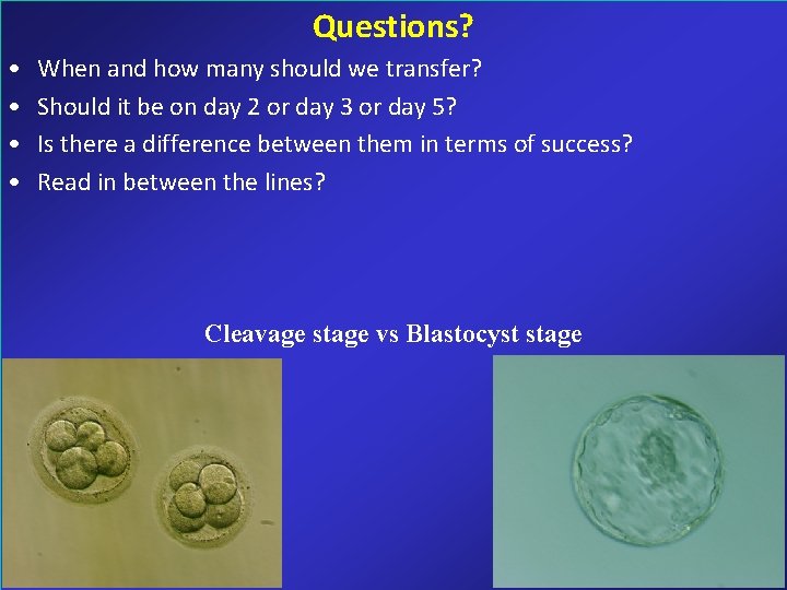 Questions? • • When and how many should we transfer? Should it be on Questions? • • When and how many should we transfer? Should it be on