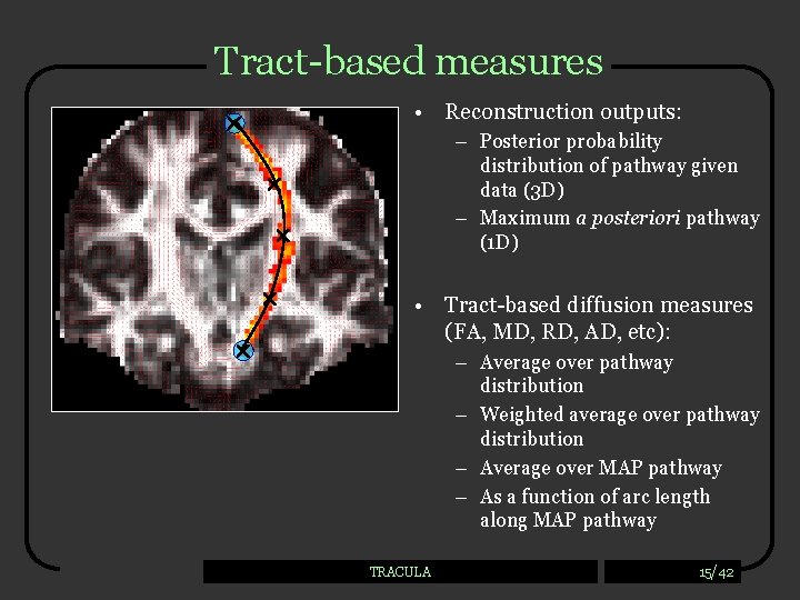 Tract-based measures • Reconstruction outputs: – Posterior probability distribution of pathway given data (3
