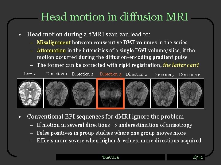 Head motion in diffusion MRI • Head motion during a d. MRI scan lead