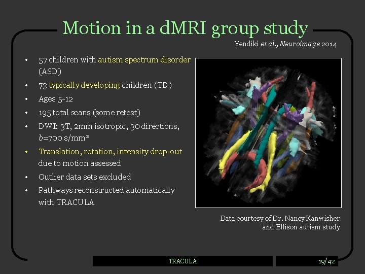 Motion in a d. MRI group study Yendiki et al. , Neuroimage 2014 •