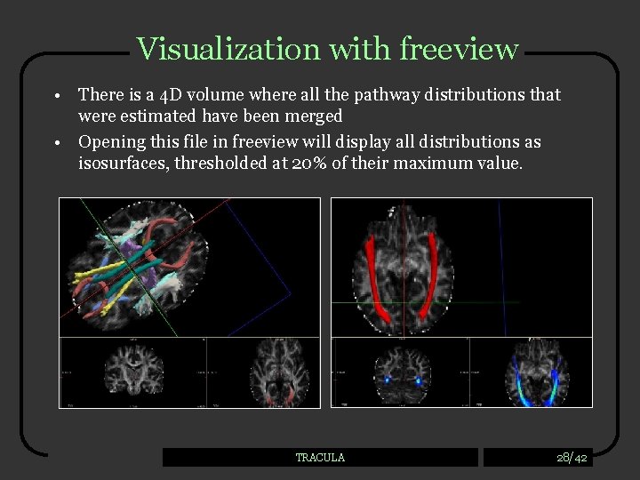 Visualization with freeview • There is a 4 D volume where all the pathway