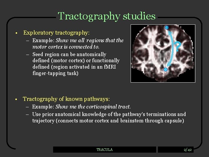 Tractography studies • Exploratory tractography: – Example: Show me all regions that the motor