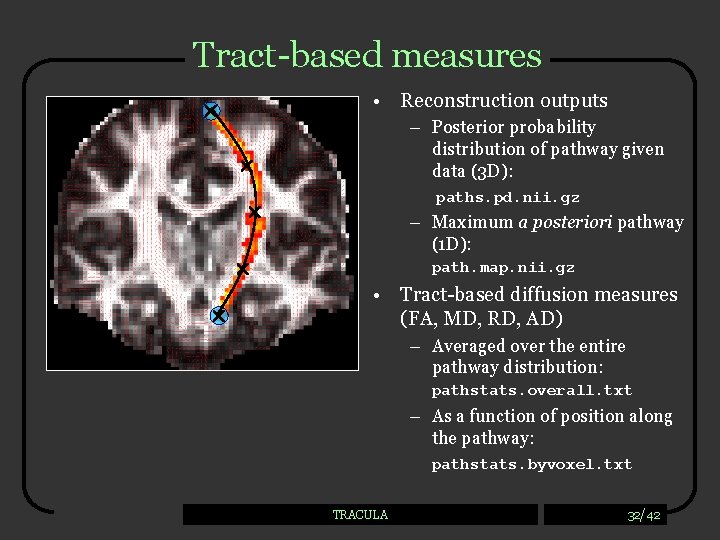 Tract-based measures • Reconstruction outputs – Posterior probability distribution of pathway given data (3