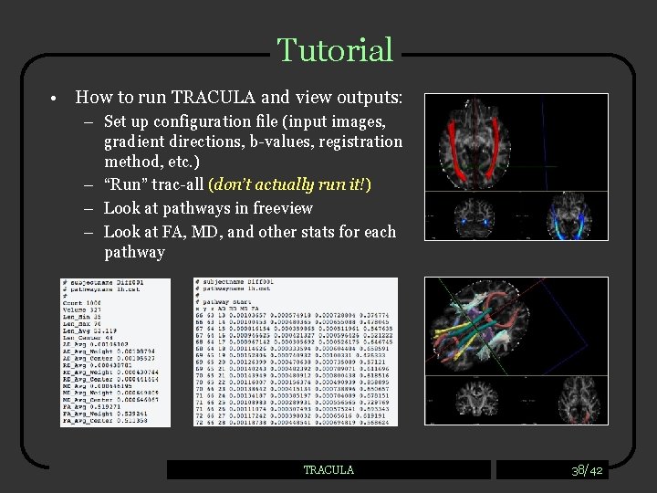 Tutorial • How to run TRACULA and view outputs: – Set up configuration file
