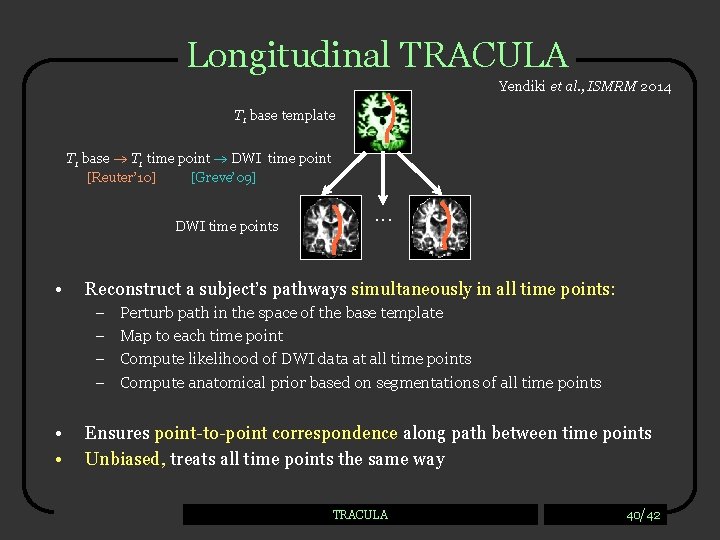 Longitudinal TRACULA Yendiki et al. , ISMRM 2014 T 1 base template T 1