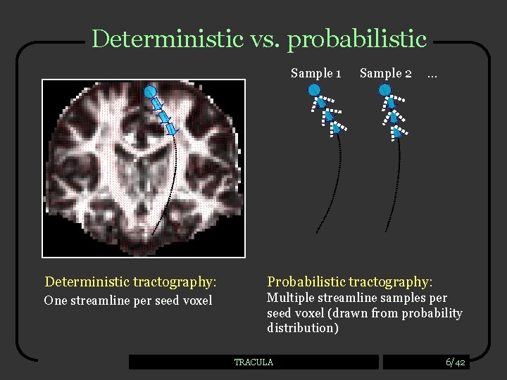 Deterministic vs. probabilistic Sample 1 Sample 2 … Deterministic tractography: Probabilistic tractography: One streamline