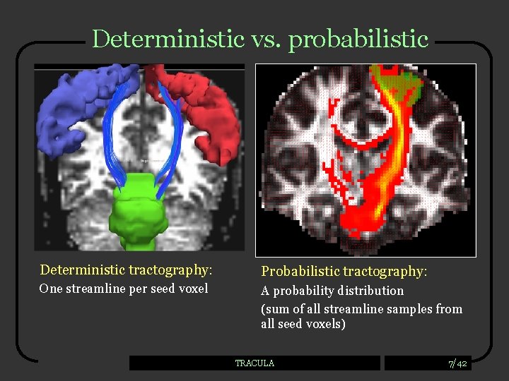 Deterministic vs. probabilistic Deterministic tractography: Probabilistic tractography: One streamline per seed voxel A probability
