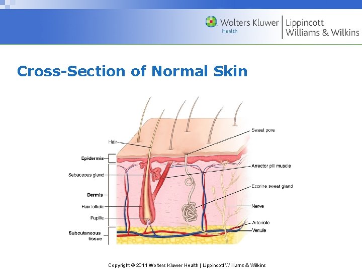 Cross-Section of Normal Skin Copyright © 2011 Wolters Kluwer Health | Lippincott Williams & Cross-Section of Normal Skin Copyright © 2011 Wolters Kluwer Health | Lippincott Williams &