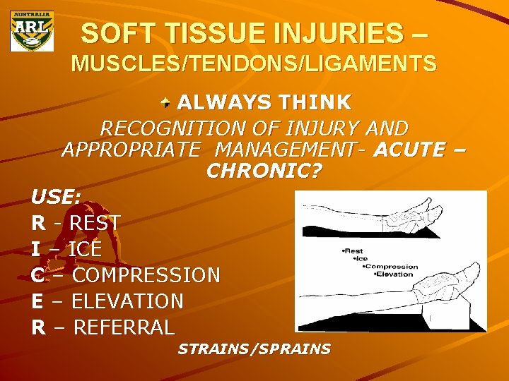 SOFT TISSUE INJURIES – MUSCLES/TENDONS/LIGAMENTS ALWAYS THINK RECOGNITION OF INJURY AND APPROPRIATE MANAGEMENT- ACUTE