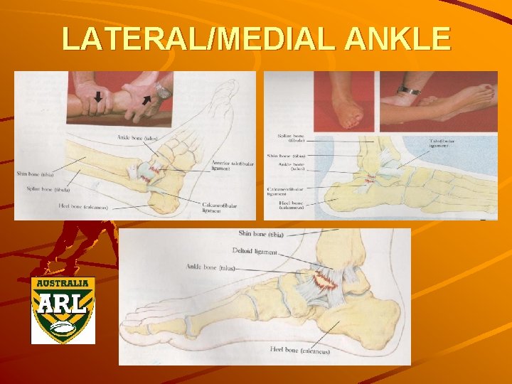 LATERAL/MEDIAL ANKLE 
