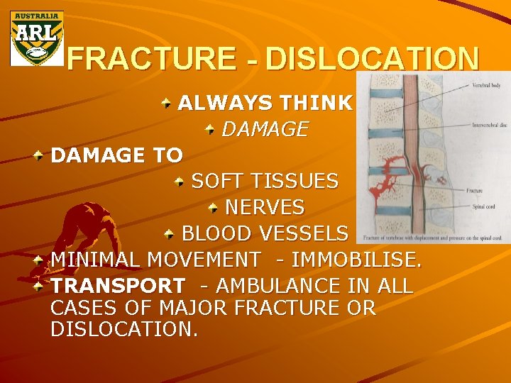 FRACTURE - DISLOCATION ALWAYS THINK DAMAGE TO SOFT TISSUES NERVES BLOOD VESSELS MINIMAL MOVEMENT
