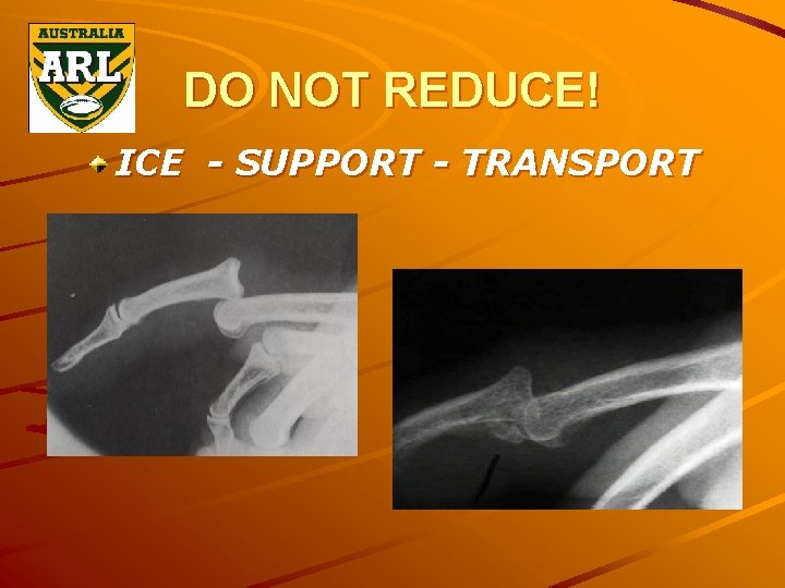 DO NOT REDUCE! ICE - SUPPORT - TRANSPORT 