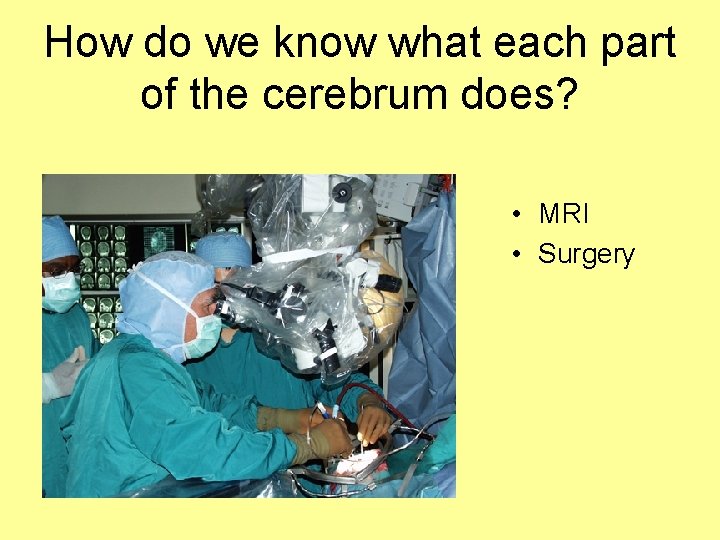 How do we know what each part of the cerebrum does? • MRI •
