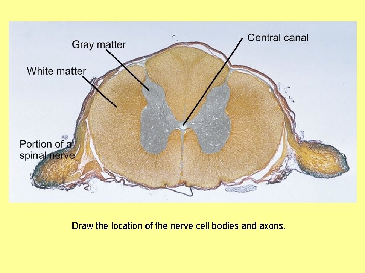 Draw the location of the nerve cell bodies and axons. 