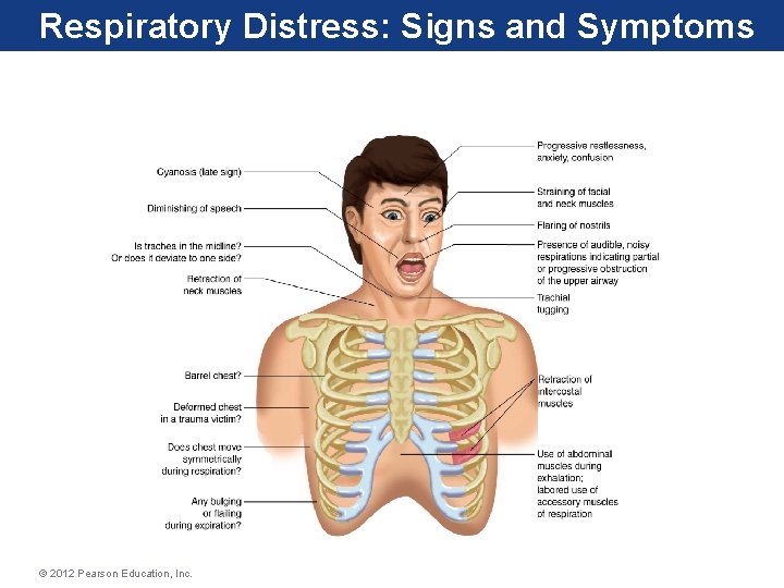 Respiratory Distress: Signs and Symptoms © 2012 Pearson Education, Inc. Respiratory Distress: Signs and Symptoms © 2012 Pearson Education, Inc.