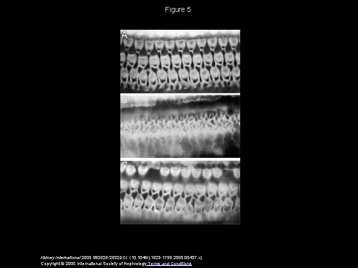 Figure 5 Kidney International 2000 582525 -2532 DOI: (10. 1046/j. 1523 -1755. 2000. 00437.