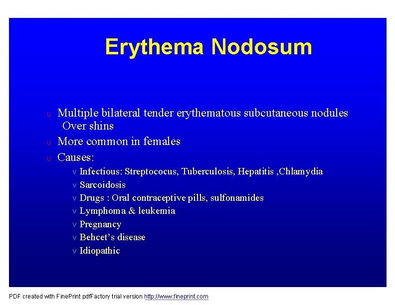 Erythema Nodosum u u u Multiple bilateral tender erythematous subcutaneous nodules Over shins More