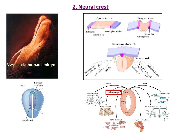 2. Neural crest 3 week-old human embryo 