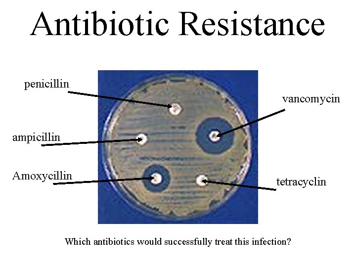 Antibiotic Resistance penicillin vancomycin ampicillin Amoxycillin tetracyclin Which antibiotics would successfully treat this infection?