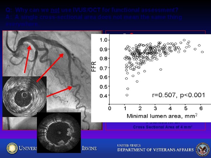 Q: Why can we not use IVUS/OCT for functional assessment? A: A single cross-sectional