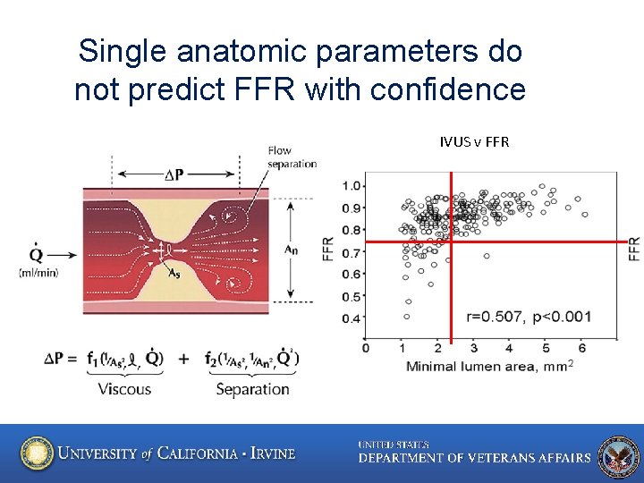 Single anatomic parameters do not predict FFR with confidence IVUS v FFR 