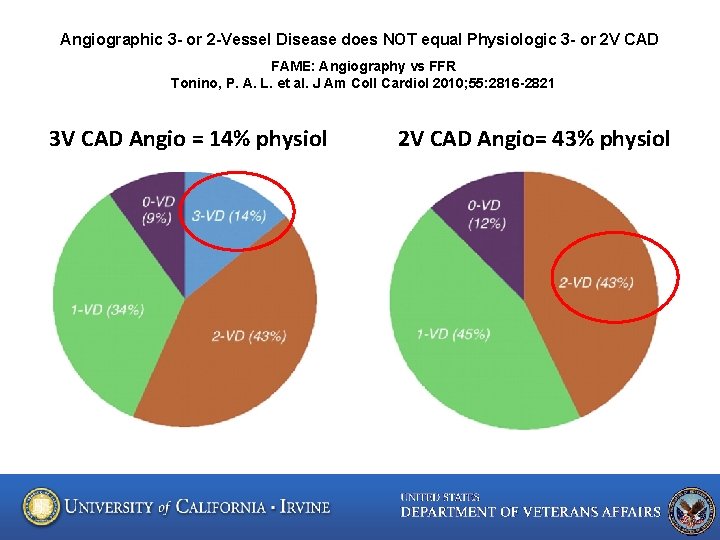 Angiographic 3 - or 2 -Vessel Disease does NOT equal Physiologic 3 - or
