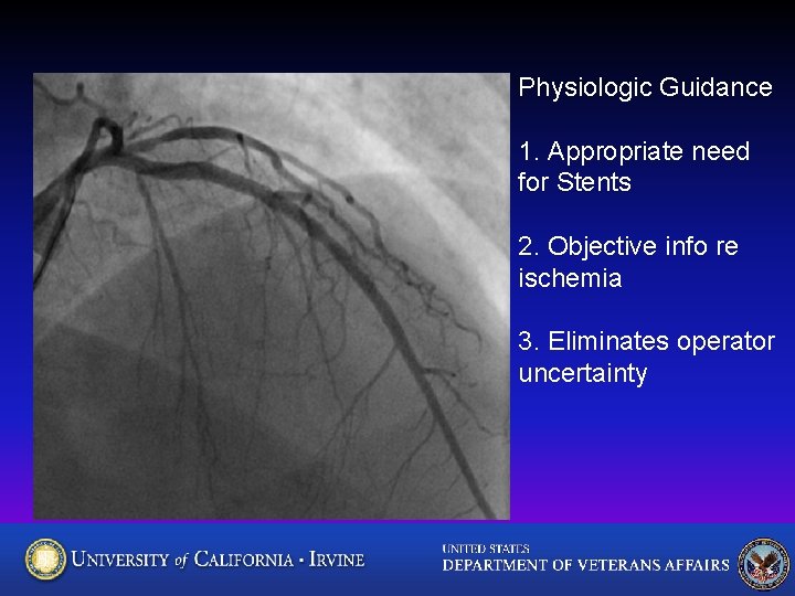 Physiologic Guidance 1. Appropriate need for Stents 2. Objective info re ischemia 3. Eliminates