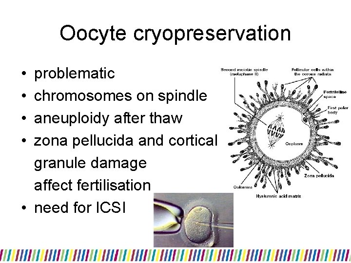 Oocyte cryopreservation • • problematic chromosomes on spindle aneuploidy after thaw zona pellucida and