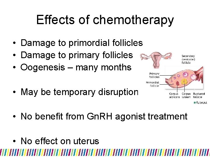 Effects of chemotherapy • Damage to primordial follicles • Damage to primary follicles •