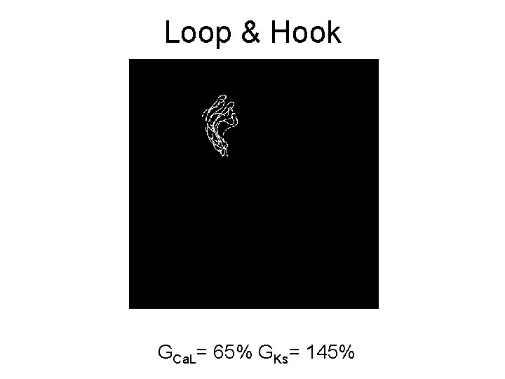 Loop & Hook GCa. L= 65% GKs= 145% 