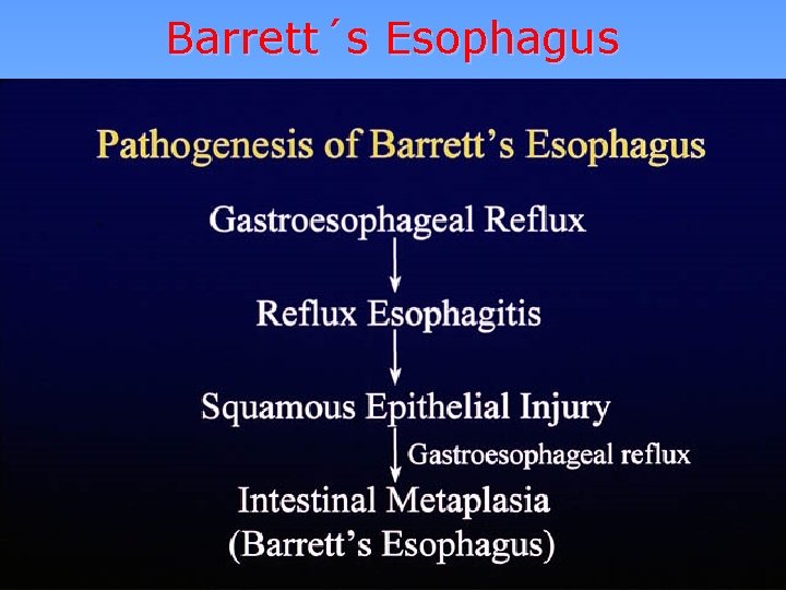 Barrett´s Esophagus 