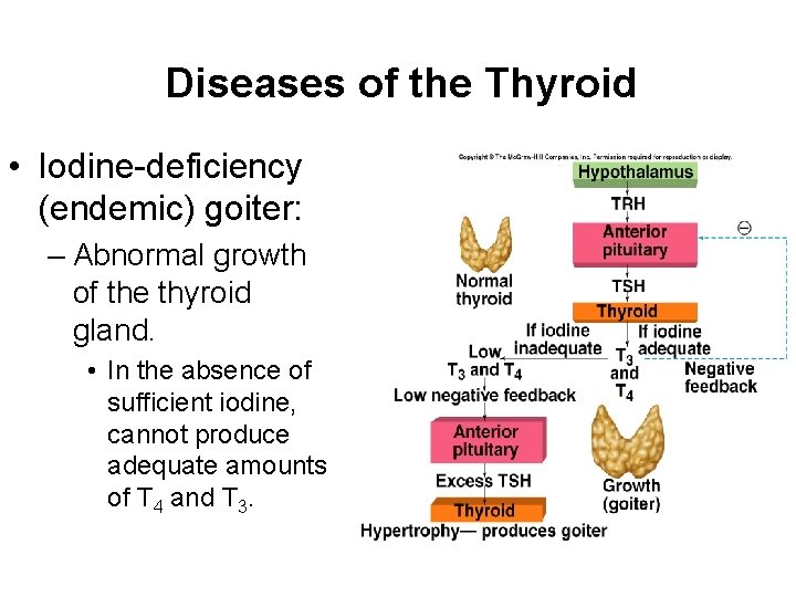 Diseases of the Thyroid • Iodine-deficiency (endemic) goiter: – Abnormal growth of the thyroid Diseases of the Thyroid • Iodine-deficiency (endemic) goiter: – Abnormal growth of the thyroid