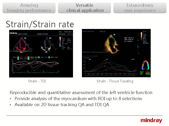 Amazing Imaging performance Versatile clinical application Extraordinary user experience Strain/Strain rate Strain - TDI