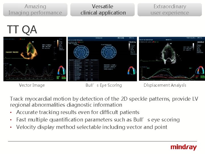 Amazing Imaging performance Versatile clinical application Extraordinary user experience TT QA Vector Image Bull’s