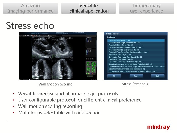 Amazing Imaging performance Versatile clinical application Extraordinary user experience Stress echo Wall Motion Scoring