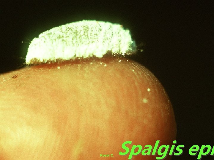 Spalgis epi 