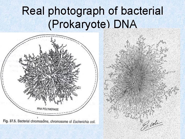 Real photograph of bacterial (Prokaryote) DNA 