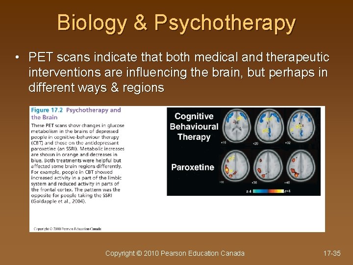 Biology & Psychotherapy • PET scans indicate that both medical and therapeutic interventions are
