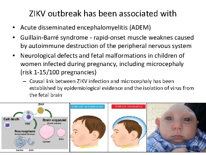 ZIKV outbreak has been associated with • Acute disseminated encephalomyelitis (ADEM) • Guillain-Barré syndrome