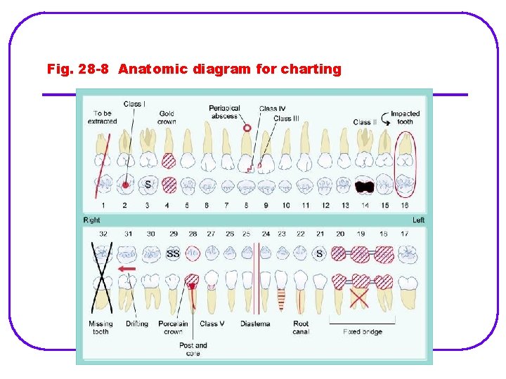 Fig. 28 -8 Anatomic diagram for charting 