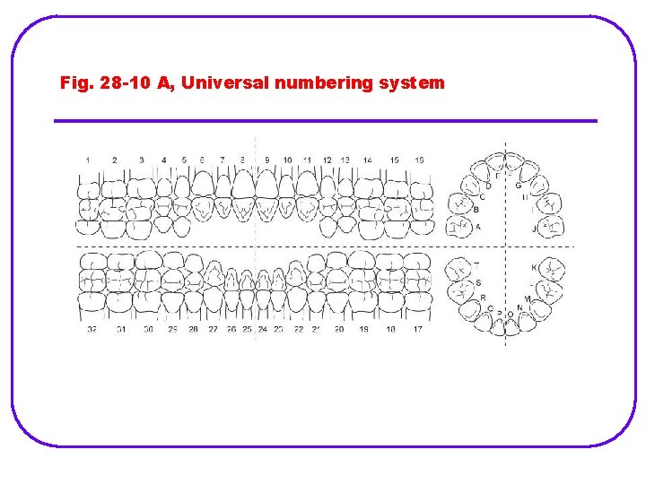 Fig. 28 -10 A, Universal numbering system 