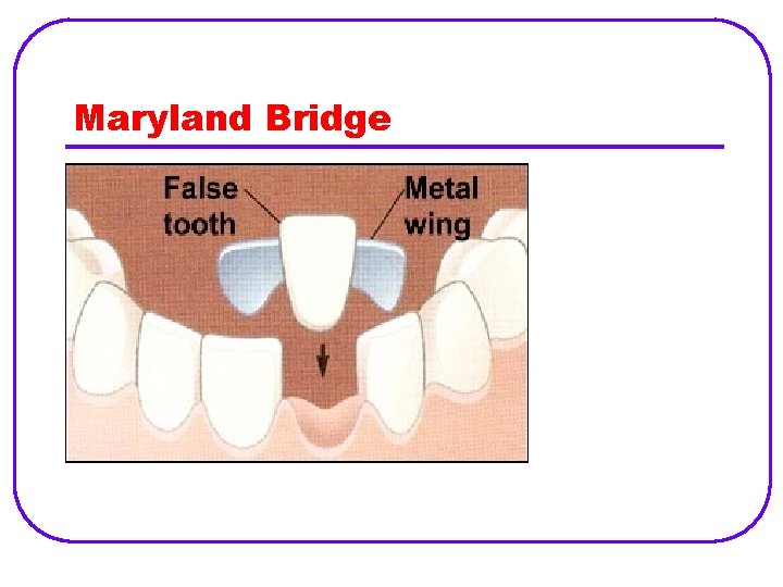 Maryland Bridge 